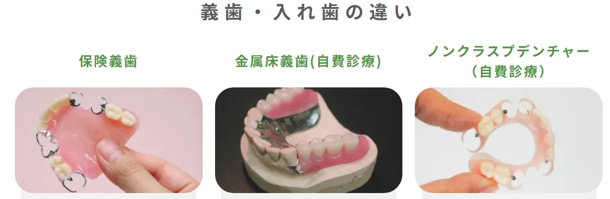 義歯（入れ歯） | 別府市の歯科・歯医者なら鉄輪歯科クリニック